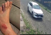 Casal atropelado em Avaré cobra falta de assistência após promessa não cumprida pela família