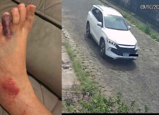 Casal atropelado em Avaré cobra falta de assistência após promessa não cumprida pela família