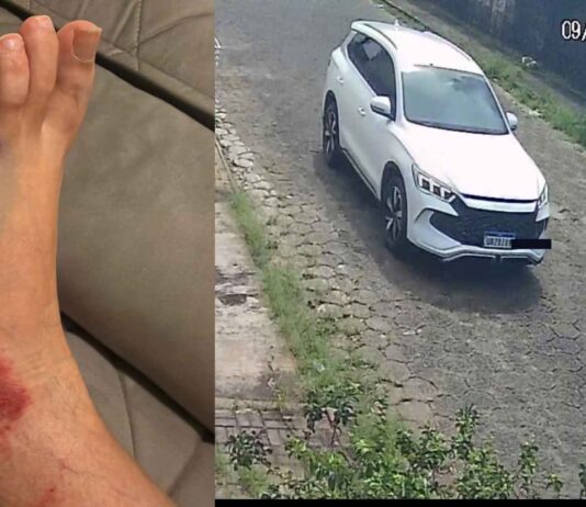 Casal atropelado em Avaré cobra falta de assistência após promessa não cumprida pela família